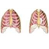 reconnaitre un cancer des poumons