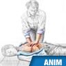 Cur, massage cardiaque externe