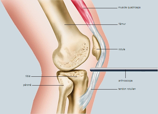 Arthroscope