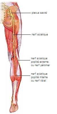 sciatique - LAROUSSE