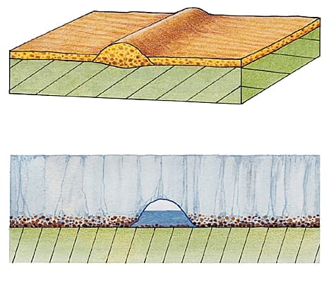 Formation d'un ôs