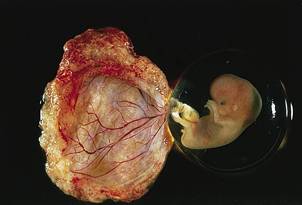 Fœtus de 8 semaines