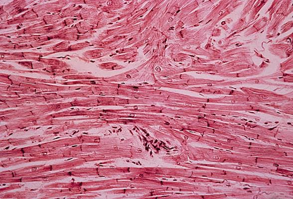 Cellules musculaires du myocarde