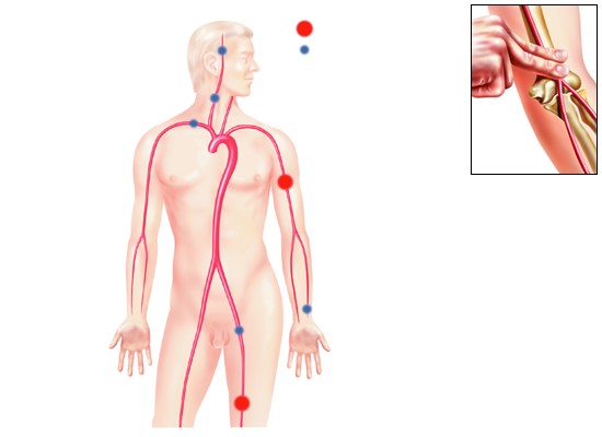 Points de compression