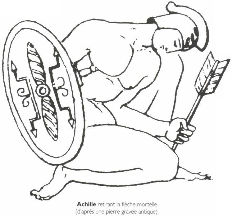 Achille retirant la flèche mortelle.