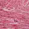 Cellules musculaires du myocarde